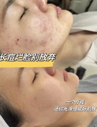 -Cream88颜皮肤管理中心