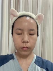 体验前-亿美医疗美容·半岛大超炮官方授权店
