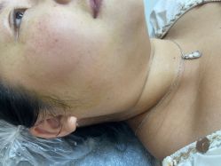 -长沙雅美医疗美容医院