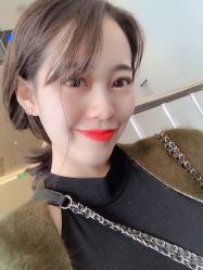 体验后-广州健丽·去眼袋医疗美容机构