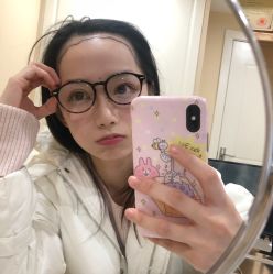 -碧莲盛不剃发植发