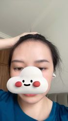 -大麦微针植发全国连锁
