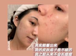 -苗方清颜痘肌研究所