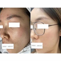 -美肤盾祛痘·问题肌头疗管理中心