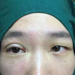 -尚玲纹绣纹眉特价店