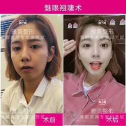 -长沙雅美医疗美容医院