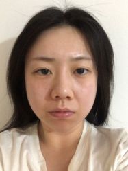 点击看大图 体验前-深圳美莱医疗美容医院