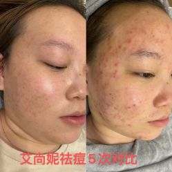 -艾尚妮·美容美体SPA