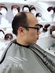 -发饰美男士增发补发假发定制店