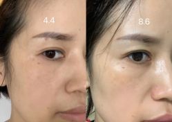 点击看大图 -深圳美莱医疗美容医院