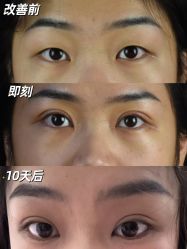 -Yestar重庆艺星医疗美容医院