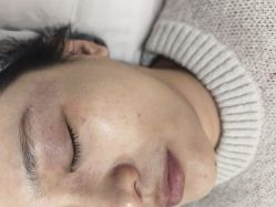 -长沙雅美医疗美容医院