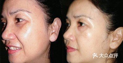 再也不能淡定了，这台仪器减肥和松弛同时解决了