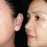 再也不能🙅淡定了，这台仪器减肥和松弛同时解决了❗❗