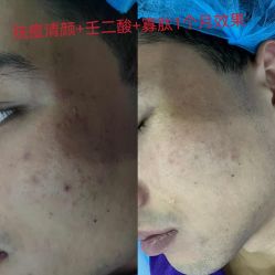 -蕾特恩专业祛痘·皮肤管理