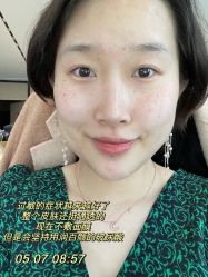体验后-北京英煌医疗美容