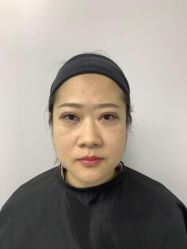 -广州健丽·去眼袋医疗美容机构