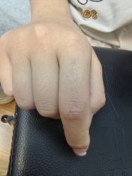 -天道专业洗纹身
