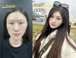 -素美医疗美容·西南眼鼻整形·修复基地