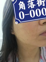 -广东韩妃整形外科医院