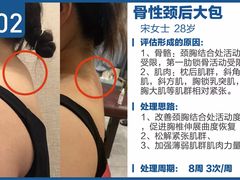 -体博士·疼痛调理·体态矫正·运动康复中心(大望路华贸店)