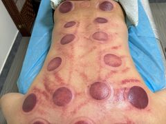 -张钰强中医正骨推拿连锁(唐家人才公寓店)
