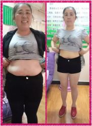 -香薇妮丝女子减肥院