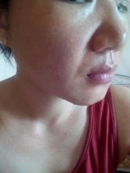 -东莞缔美美容医院