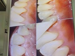 -土豆口腔(凤凰北总店)