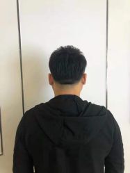 点击看大图 -极客侠男士假发定制补发