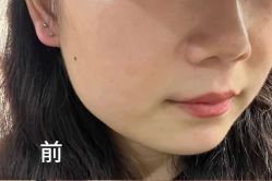 -上海伊莱美医疗美容医院