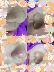 -蕾特恩祛痘•皮肤管理