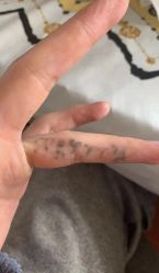 -天道专业洗纹身