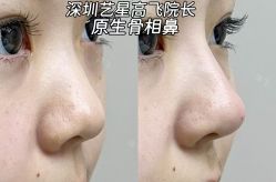 -深圳艺星医疗美容医院