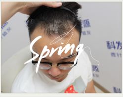 -大麦微针植发全国连锁