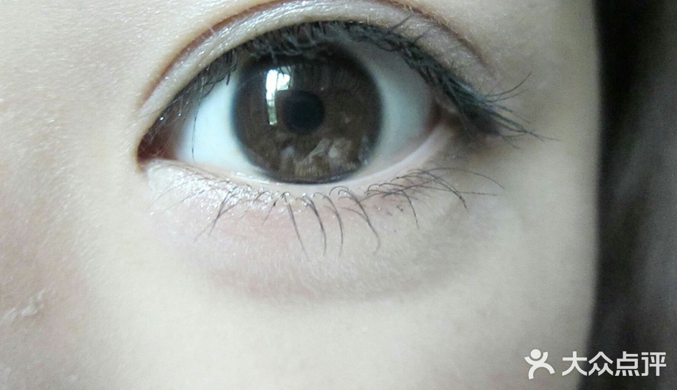 怕疼❕做双眼皮可以全麻吗❓❓