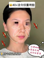 -安吉拉青春化管理中心