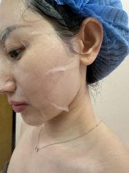 -四川米兰柏羽医学美容医院