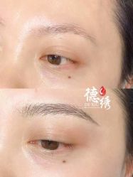 -德绣·机器野生眉发际线·美瞳线半永久