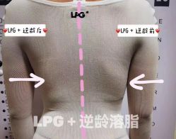 -克丽缇娜