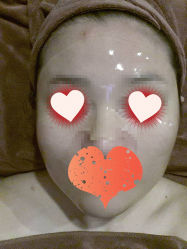 -紫御国际抗衰ZOE ANTI AGING