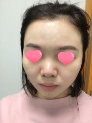 -正璞医疗美容·皮肤修复·微整注射