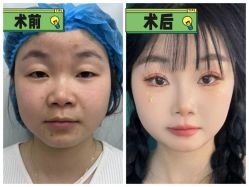 -素美医疗美容·西南眼鼻整形·修复基地