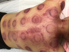 -益友堂盲人推拿正骨穴位按摩工作室