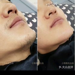 -小梨·OndaPro·专业脱毛连锁机构