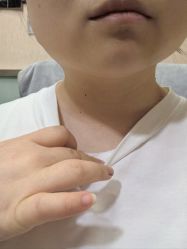 -北京美痣堂古方祛痣斑疣瘊