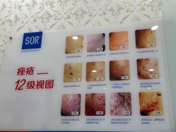 -SOR索尔祛痘·面部肌肤科学管理