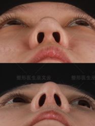 -北京米扬丽格医疗美容·联合丽格鼻整形中心