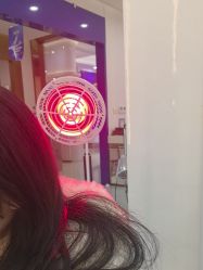 体验后-大麦微针植发全国连锁