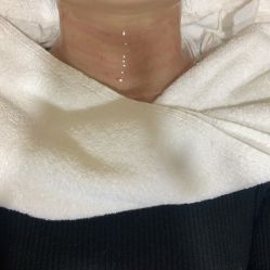 点击看大图 体验后-上海首尔丽格医疗美容医院